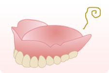 保険の入れ歯の注意点